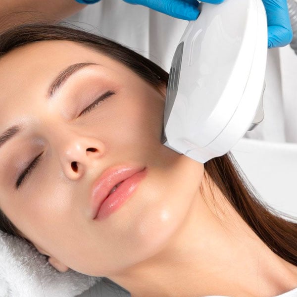 Advanced IPL device used for photorejuvenation treatments at Lougheed Laser Centre